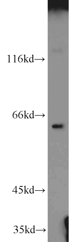 A2780 cells were subjected to SDS PAGE followed by western blot with Catalog No:111932(IRGQ antibody) at dilution of 1:1000