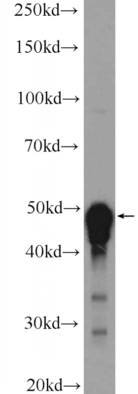 mouse eye tissue were subjected to SDS PAGE followed by western blot with Catalog No:117135(BFSP2 Antibody) at dilution of 1:3000