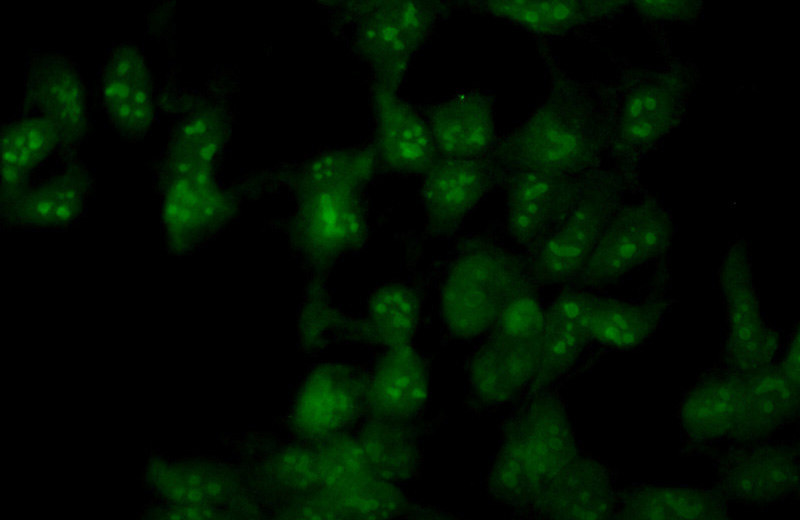Immunofluorescent analysis of (10% Formaldehyde) fixed HEK-293 cells using Catalog No:113303(NOP2 Antibody) at dilution of 1:50 and Alexa Fluor 488-congugated AffiniPure Goat Anti-Rabbit IgG(H+L)