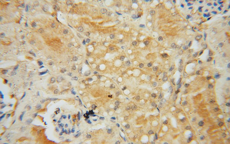 Immunohistochemical of paraffin-embedded human kidney using Catalog No:109580(CRTAP antibody) at dilution of 1:100 (under 40x lens)