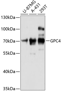 Western blot - GPC4 Polyclonal Antibody 