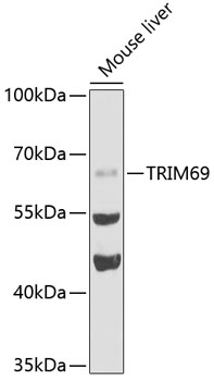 Western blot - TRIM69 Polyclonal Antibody 