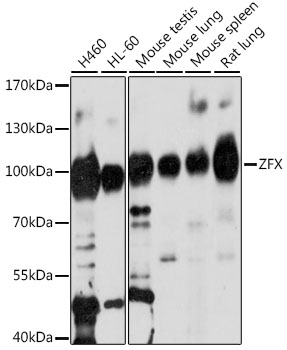 Western blot - ZFX Polyclonal Antibody 