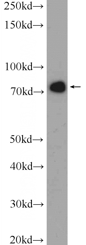 HeLa cells were subjected to SDS PAGE followed by western blot with Catalog No:109326(CKAP2 Antibody) at dilution of 1:1000