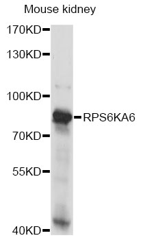 Western blot - RPS6KA6 Polyclonal Antibody 