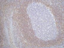 IHC staining of Human tonsil tissue paraffin-embedded, diluted at 1:200.
