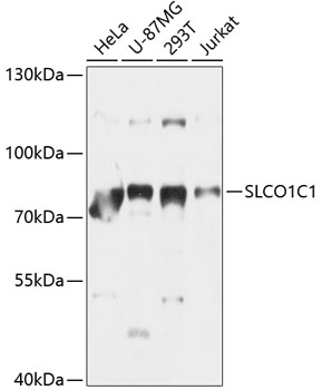Western blot - SLCO1C1 Polyclonal Antibody 