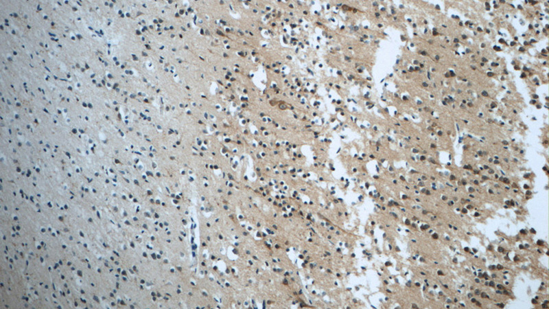 Immunohistochemistry of paraffin-embedded human brain tissue slide using Catalog No:114698(RIC8A Antibody) at dilution of 1:50 (under 10x lens)