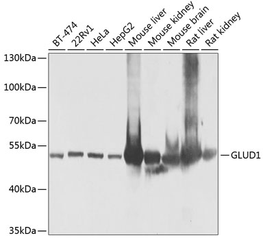 Western blot - GLUD1 Polyclonal Antibody 