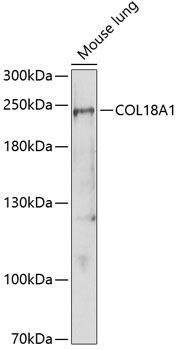 Western blot - COL18A1 Polyclonal Antibody 