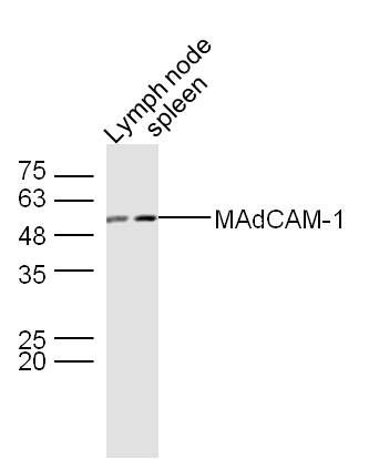Fig1: Sample:; Lymph node (Mouse) Lysate at 30 ug; Spleen (Mouse) Lysate at 30 ug; Primary: Anti- MAdCAM-1 at 1/300 dilution; Secondary: IRDye800CW Goat Anti-Rabbit IgG at 1/20000 dilution; Predicted band size: 40 kD; Observed band size: 50 kD