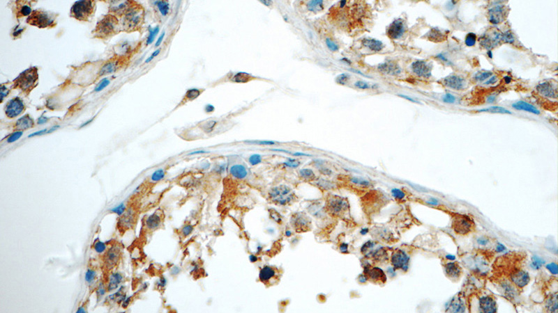 Immunohistochemistry of paraffin-embedded human testis tissue slide using Catalog No:115542(SPANXE Antibody) at dilution of 1:50 (under 40x lens)