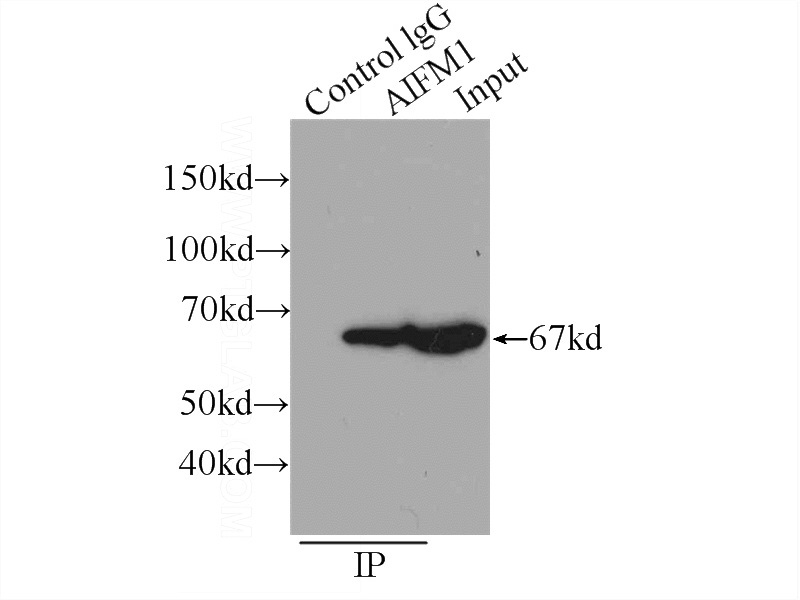 IP Result of anti-AIF (IP:Catalog No:107851, 3ug; Detection:Catalog No:107851 1:2000) with HeLa cells lysate 1320ug.