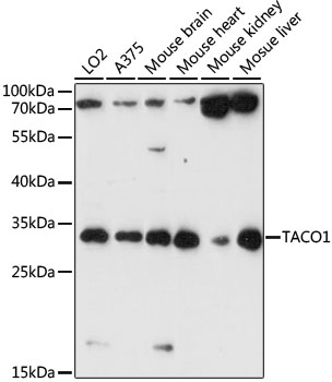 Western blot - TACO1 Polyclonal Antibody 