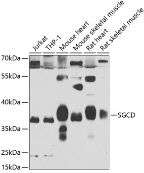 Western blot - SGCD Polyclonal Antibody 