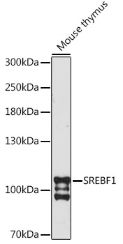 Western blot - SREBF1 Polyclonal Antibody 