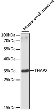 Western blot - THAP2 Polyclonal Antibody 