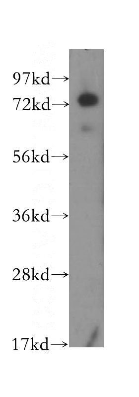 human kidney tissue were subjected to SDS PAGE followed by western blot with Catalog No:111767(IL17RE antibody) at dilution of 1:400
