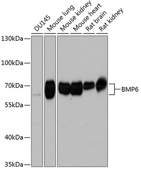 Western blot - BMP6 Polyclonal Antibody 