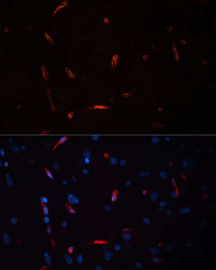 Immunofluorescence - HCRTR1 Polyclonal Antibody 