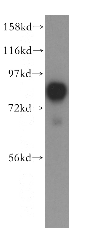 HEK-293 cells were subjected to SDS PAGE followed by western blot with Catalog No:112201(LETM1 antibody) at dilution of 1:500