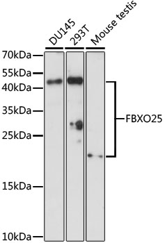 Western blot - FBXO25 Polyclonal Antibody 