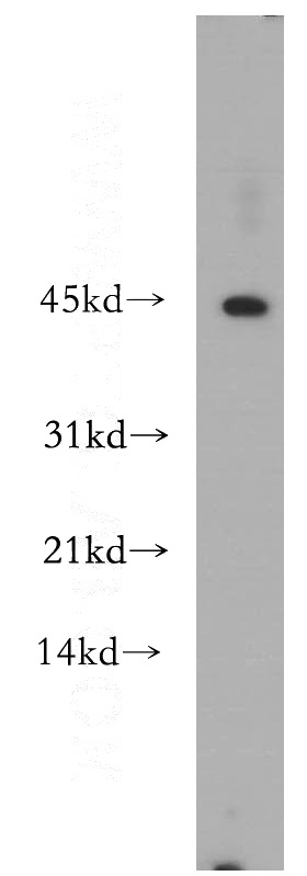 A549 cells were subjected to SDS PAGE followed by western blot with Catalog No:115014(SCPX antibody) at dilution of 1:500