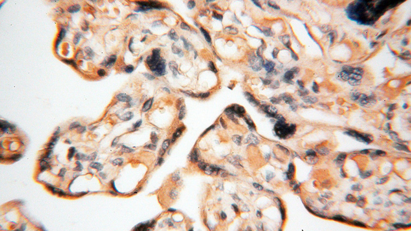 Immunohistochemical of paraffin-embedded human placenta using Catalog No:111454(HPS5 antibody) at dilution of 1:100 (under 40x lens)