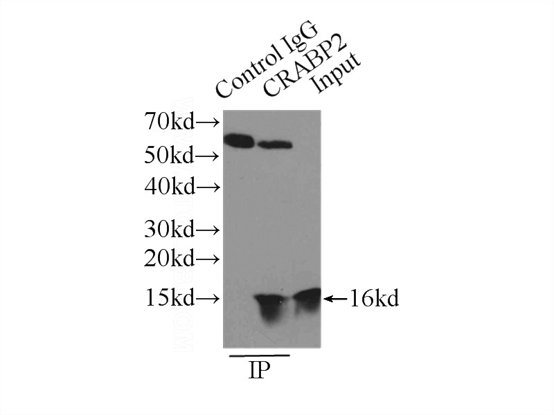 IP Result of anti-CRABP2 (IP:Catalog No:109537, 3ug; Detection:Catalog No:109537 1:300) with HeLa cells lysate 4650ug.