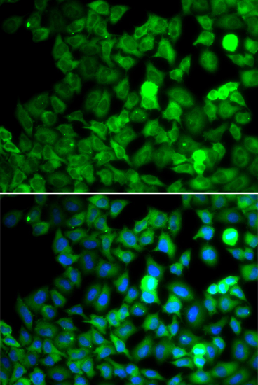 Immunofluorescence - SARS Polyclonal Antibody 