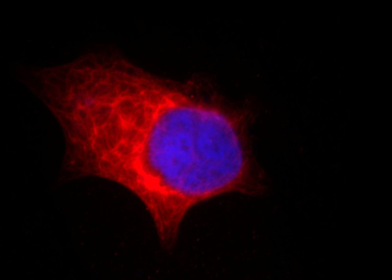 Immunofluorescent analysis of Hela cells, using TPP2 antibody Catalog No: at 1:25 dilution and Rhodamine-labeled goat anti-mouse IgG (red). Blue pseudocolor = DAPI (fluorescent DNA dye).