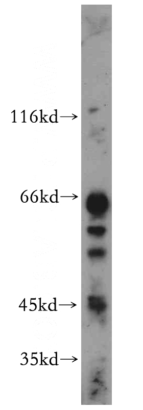 mouse brain tissue were subjected to SDS PAGE followed by western blot with Catalog No:110781(FSD1L antibody) at dilution of 1:500