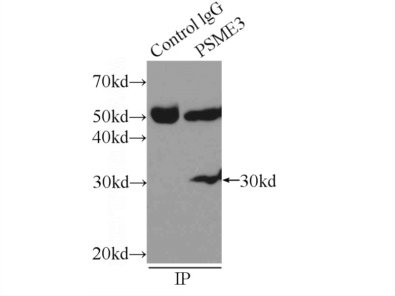IP Result of anti-PSME3 (IP:Catalog No:114248, 3ug; Detection:Catalog No:114248 1:500) with COLO 320 cells lysate 2000ug.