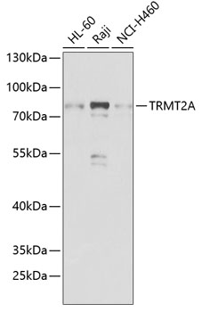 Western blot - TRMT2A Polyclonal Antibody 
