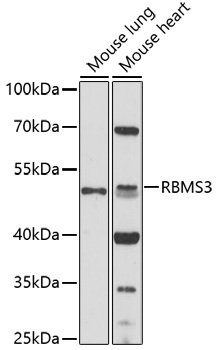 Western blot - RBMS3 Polyclonal Antibody 