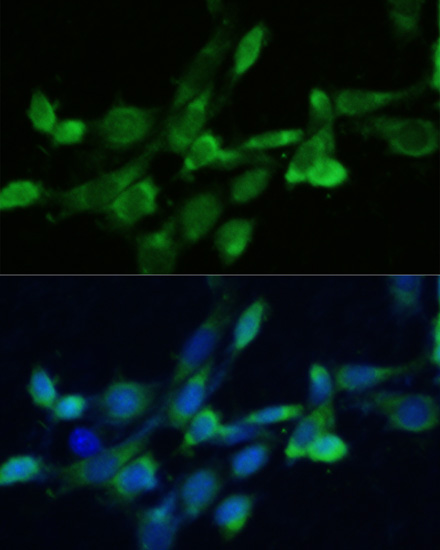Immunofluorescence - FDFT1 Polyclonal Antibody 