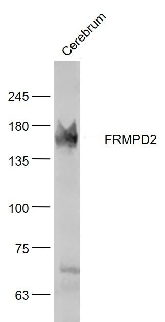 Fig1: Sample:; Cerebrum (Mouse) Lysate at 40 ug; Primary: Anti- FRMPD2 at 1/1000 dilution; Secondary: IRDye800CW Goat Anti-Rabbit IgG at 1/20000 dilution; Predicted band size: 144 kD; Observed band size: 144 kD