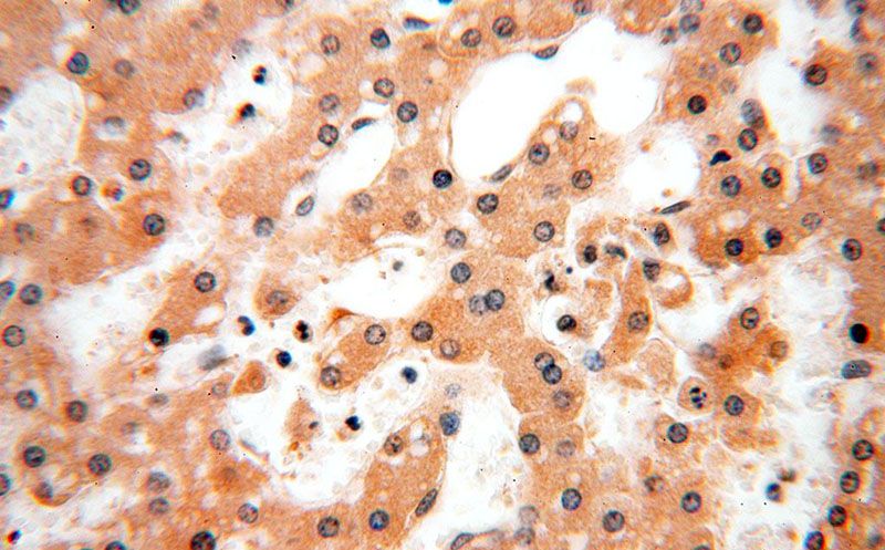 Immunohistochemical of paraffin-embedded human liver using Catalog No:115866(TBC1D23 antibody) at dilution of 1:100 (under 40x lens)