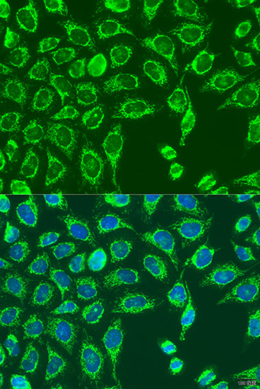 Immunofluorescence - MATN3 Polyclonal Antibody 