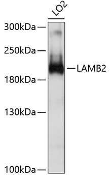 Western blot - LAMB2 Polyclonal Antibody 