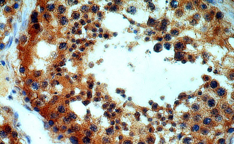 Immunohistochemical of paraffin-embedded human testis using Catalog No:114739(RNF133 antibody) at dilution of 1:50 (under 40x lens)