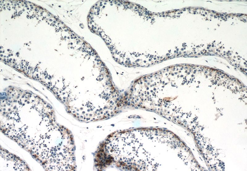 Immunohistochemistry of paraffin-embedded human testis tissue slide using Catalog No:114474(RASA1 Antibody) at dilution of 1:50 (under 10x lens)