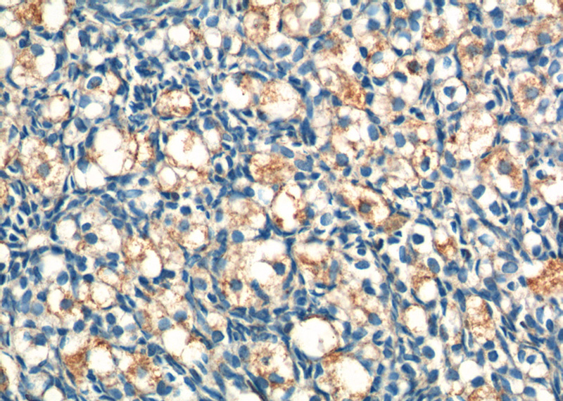 Immunohistochemistry of paraffin-embedded human ovary tissue slide using Catalog No:116019(TGFB1 Antibody) at dilution of 1:200 (under 40x lens).