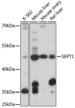 Western blot - SEPT1 Polyclonal Antibody 