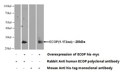 Transfected HEK-293 cells were subjected to SDS PAGE followed by western blot with Catalog No:110296(ECOP Antibody) at dilution of 1:1000