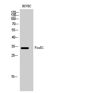 Fig1:; Western Blot analysis of HUVEC cells using FoxE1 Polyclonal Antibody cells nucleus extracted by Minute TM Cytoplasmic and Nuclear Fractionation kit (SC-003,Inventbiotech,MN,USA).