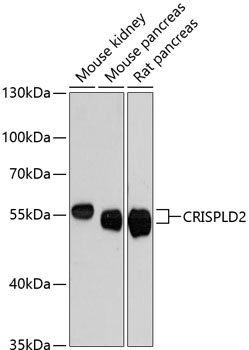 Western blot - CRISPLD2 Polyclonal Antibody 