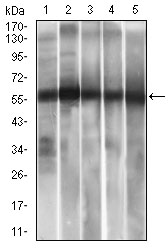 Western blot analysis using ALDH2 mouse mAb against HepG2 (1), A549 (2) cell lysateuff0c and Rat liver (3), Mouse liver (4), Mouse brain (5) tissue lysate.