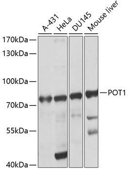 Western blot - POT1 Polyclonal Antibody 