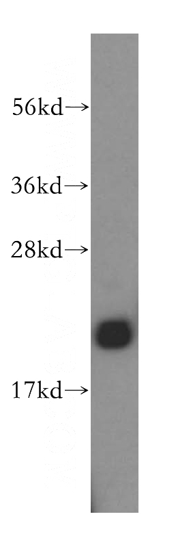 mouse liver tissue were subjected to SDS PAGE followed by western blot with Catalog No:111394(HEBP1 antibody) at dilution of 1:500